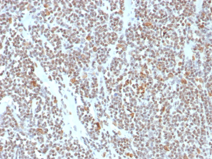 ATRX Antibody (ATRX/7940)
