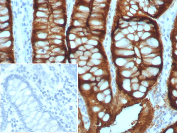 Villin 1 Antibody (VIL1/8105R) Villin 1 Antibody (VIL1/8105R) - Azide and BSA Free