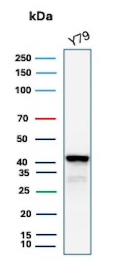 Glutamine Synthetase Antibody (GLUL/8517R) Western Blot: Glutamine Synthetase Antibody (GLUL/8517R) [NBP3-20329] -
