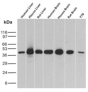 Glutamine Synthetase Antibody (GLUL/8517R) Western Blot: Glutamine Synthetase Antibody (GLUL/8517R) [NBP3-20329] -