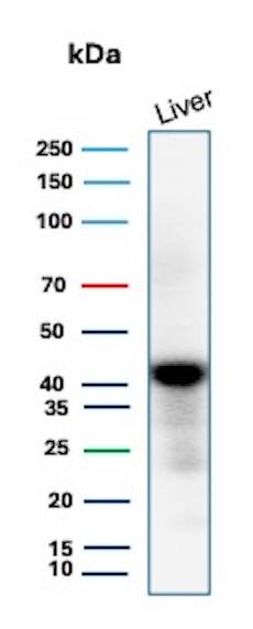 Glutamine Synthetase Antibody (GLUL/8517R) Western Blot: Glutamine Synthetase Antibody (GLUL/8517R) [NBP3-20329] -