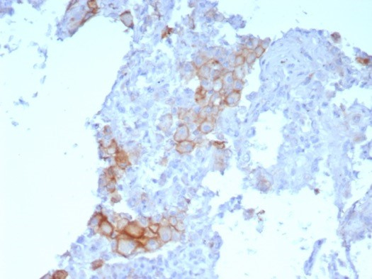 PD-L1 Antibody (PDL1/7568R)