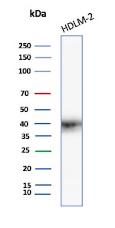 PD-L1 Antibody (PDL1/7568R) Western Blot: PD-L1 Antibody (PDL1/7568R) [NBP3-20330] -