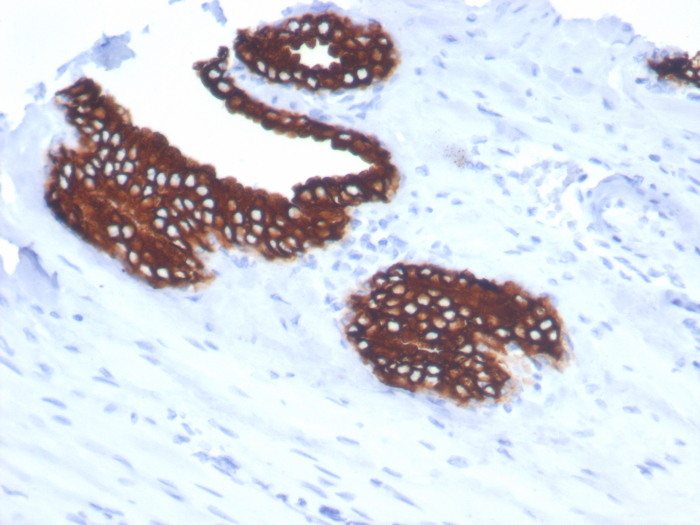 Cytokeratin 18 Antibody (KRT18/7056R)