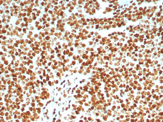 Ku80/XRCC5 Antibody (XRCC5/8093R)
