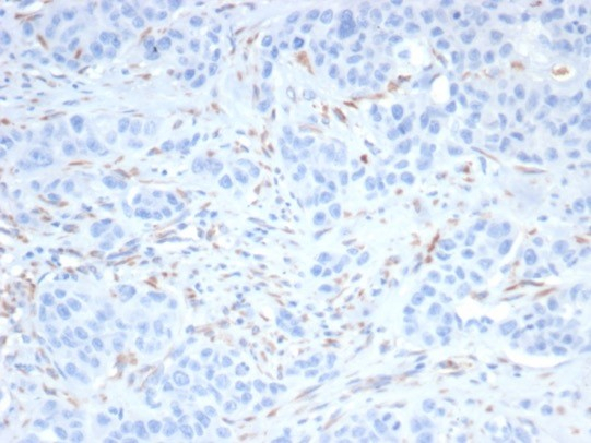 SALL4 Antibody (SALL4/7802)