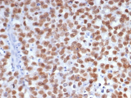 SALL4 Antibody (SALL4/7802)