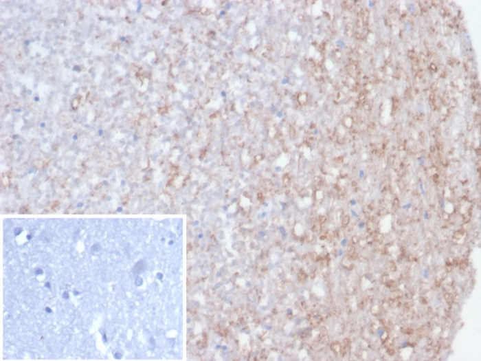 Calretinin Antibody (rCALB2/7123)