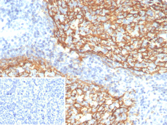 CD21 Antibody (CR2/7185R)
