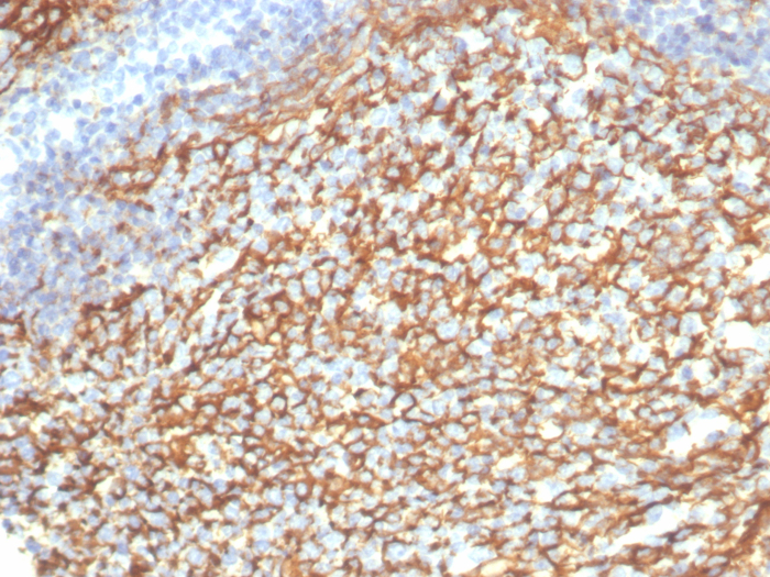 CD21 Antibody (CR2/7185R)