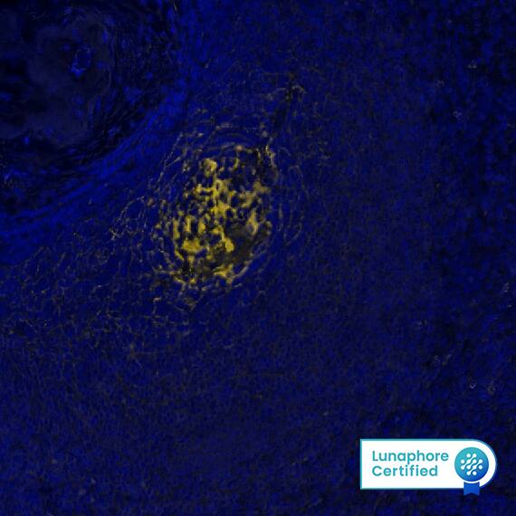 CD21 Antibody (CR2/7185R) CD21 Antibody (CR2/7185R)