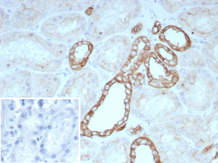 Occludin Antibody (rOCLN/8776)