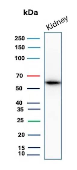 Occludin Antibody (rOCLN/8525) Western Blot: Occludin Antibody (rOCLN/8525) [NBP3-20356] -