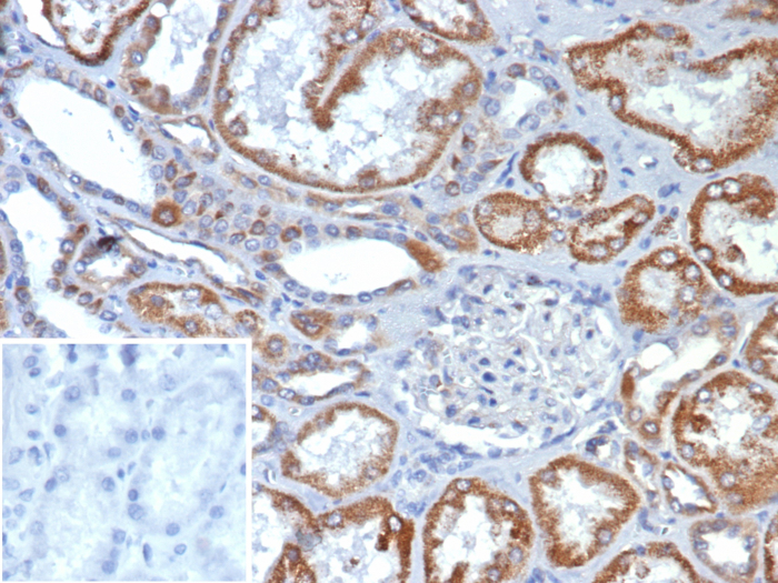 FGF-23 Antibody (FGF23/132)