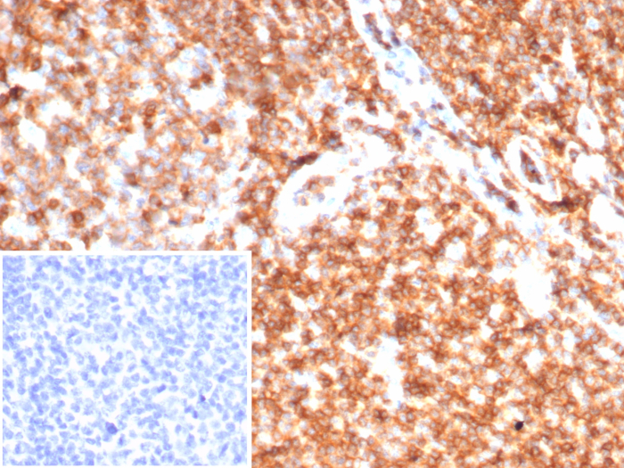 CD45 Antibody (rPTPRC/7275)