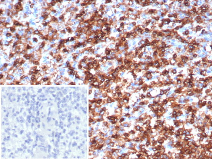 CD45 Antibody (rPTPRC/1147)