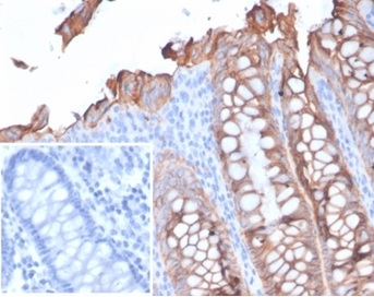EpCAM/TROP1 Antibody (rEGP40/7133)