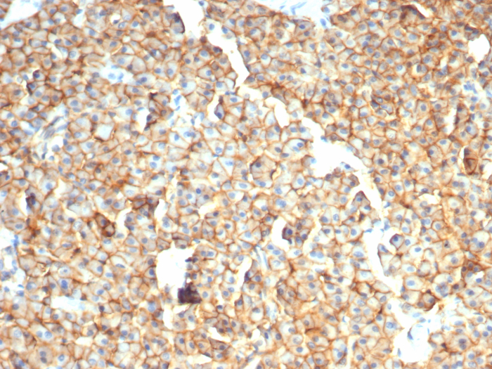 EpCAM/TROP1 Antibody (rEGP40/7334)