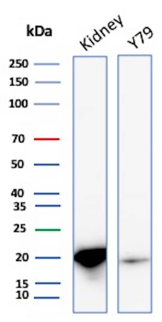 AlphaB Crystallin/CRYAB Antibody (CRYAB/4661) Western Blot: AlphaB Crystallin/CRYAB Antibody (CRYAB/4661) [NBP3-20370] -