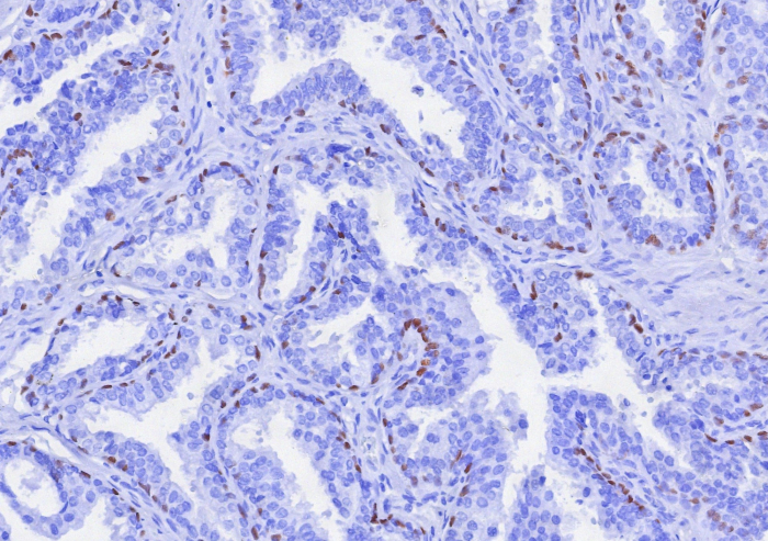 p63/TP73L Antibody (TP63/7807R)