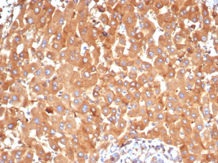 alpha 2-Macroglobulin Antibody (A2M/6554)