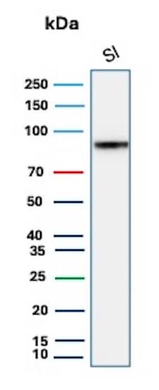 Cadherin-17 Antibody (CDH17/8515R) Western Blot: Cadherin-17 Antibody (CDH17/8515R) [NBP3-20384] -