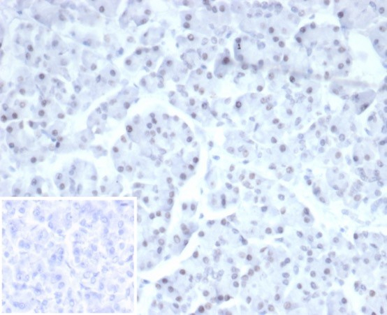 PHOX2B Antibody (PHOX2B/7161R)