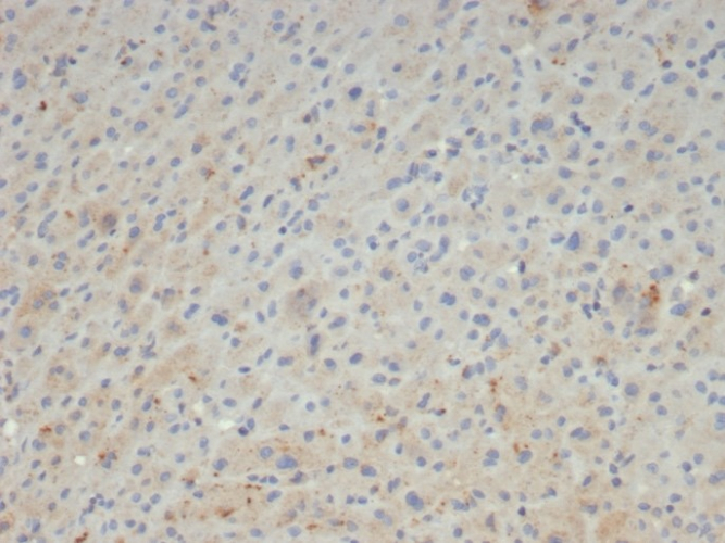alpha 2-Macroglobulin Antibody (A2M/4847)