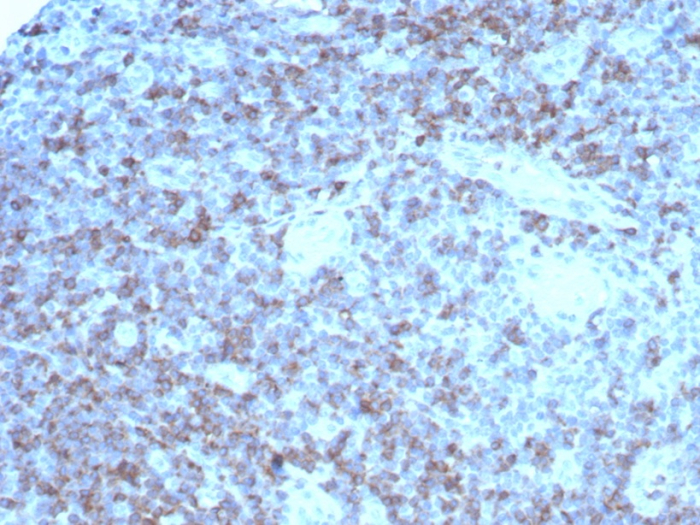 CD2 Antibody (rLFA2/8516)