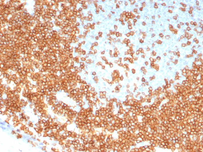 CD3 epsilon Antibody (C3e/8115R)