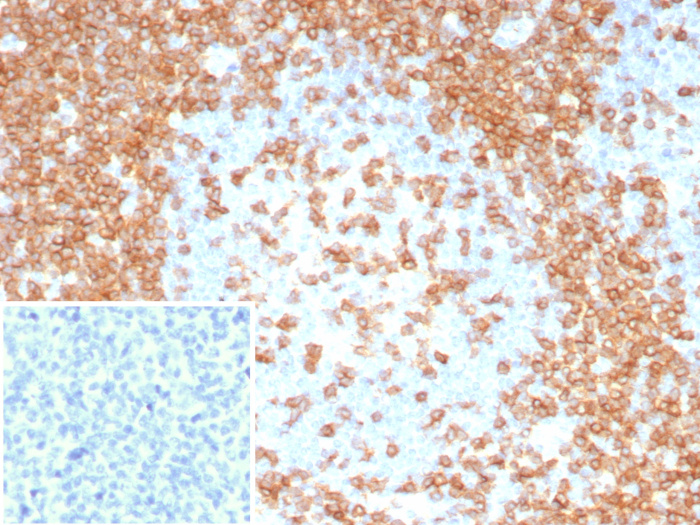 CD3 epsilon Antibody (C3e/8115R)