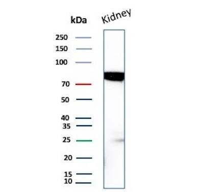 MDM2/HDM2 Antibody (MDM2/7942) Western Blot: MDM2/HDM2 Antibody (MDM2/7942) [NBP3-20406] -