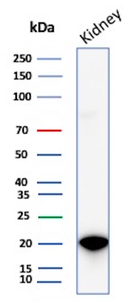 AlphaB Crystallin/CRYAB Antibody (CRYAB/4665) Western Blot: AlphaB Crystallin/CRYAB Antibody (CRYAB/4665) [NBP3-20408] -