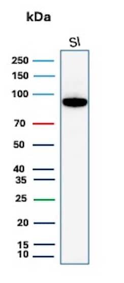 Cadherin-17 Antibody (rCDH17/8512) Western Blot: Cadherin-17 Antibody (rCDH17/8512) [NBP3-20413] -