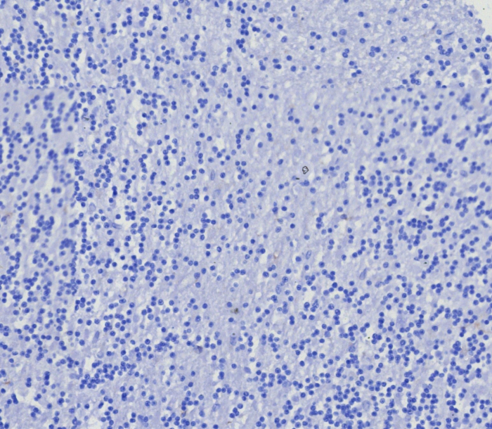 CD4 Antibody (CD4/8203R)