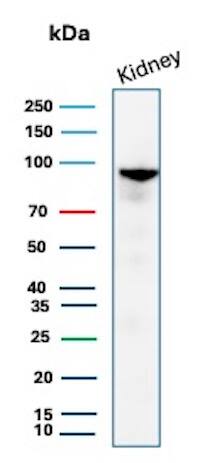 ACE-2 Antibody (ACE2/8748R) Western Blot: ACE-2 Antibody (ACE2/8748R) [NBP3-20417] -