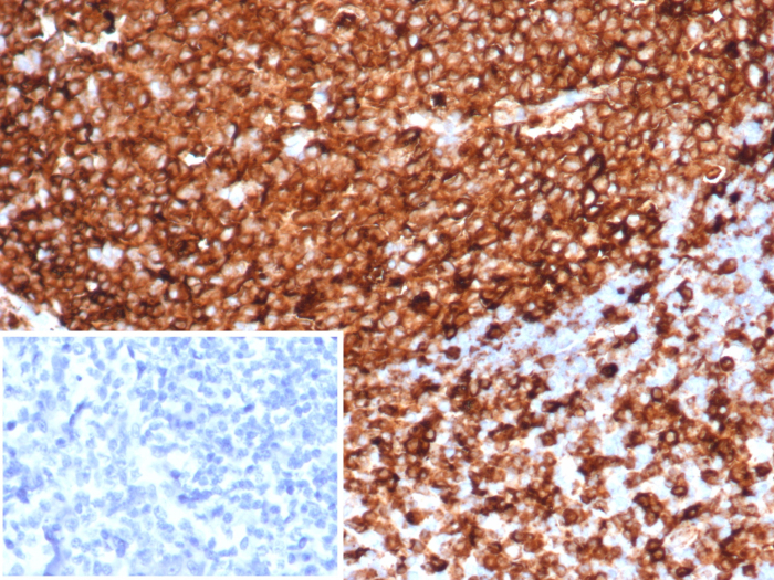 HLA-DR Antibody (HLA-DRA/6839R)
