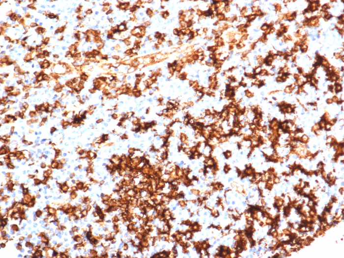 HLA-DR Antibody (HLA-DRA/6839R)