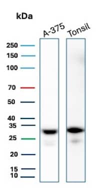 HLA-DR Antibody (HLA-DRA/6840R) Western Blot: HLA-DR Antibody (HLA-DRA/6840R) [NBP3-20427] -