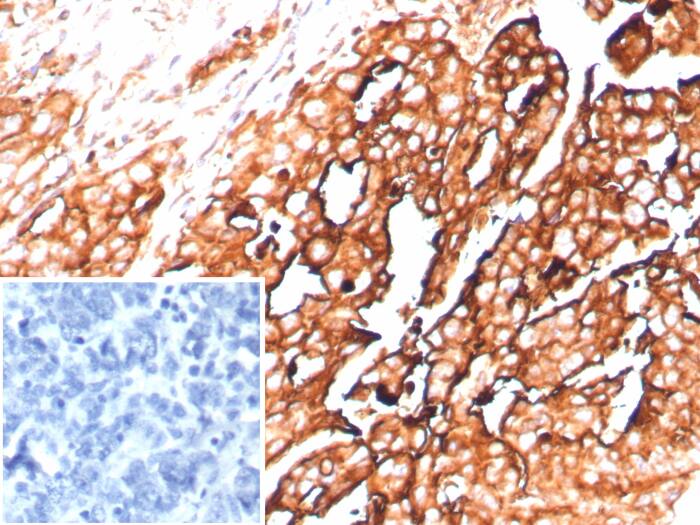 Mesothelin Antibody (rMSLN/8764) Mesothelin Antibody (rMSLN/8764) - Azide and BSA Free