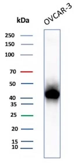Mesothelin Antibody (rMSLN/8764) Western Blot: Mesothelin Antibody (rMSLN/8764) [NBP3-20432] -