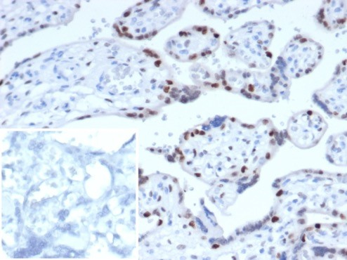 p57 Kip2 Antibody (KIP2/7187)
