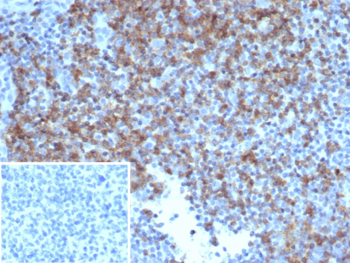 CD6 Antibody (rC6/372)