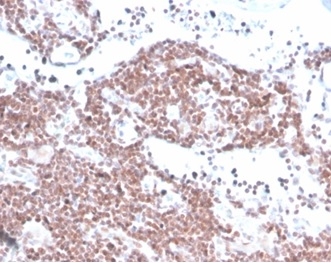 MGMT Antibody (MGMT/4791)