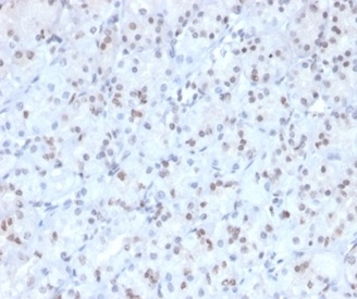 MGMT Antibody (MGMT/4791)
