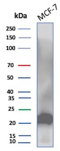 MGMT Antibody (MGMT/8364R) Western Blot: MGMT Antibody (MGMT/8364R) [NBP3-20443] -