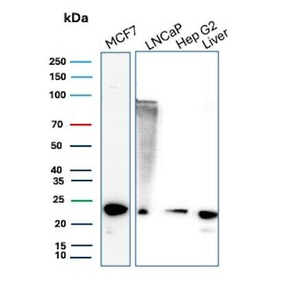 MGMT Antibody (MGMT/8364R) Western Blot: MGMT Antibody (MGMT/8364R) [NBP3-20443] -