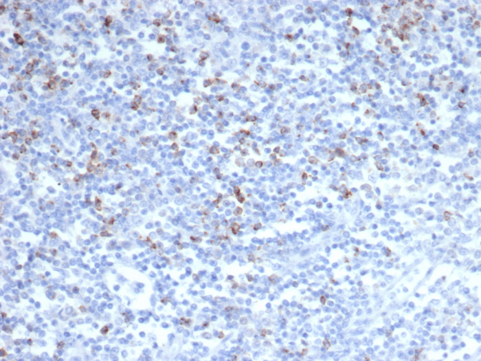CTLA-4 Antibody (CTLA4/6864R)