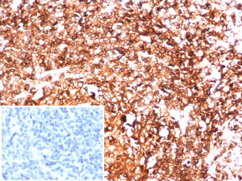 HLA-DR Antibody (HLA-DRA/6844R)