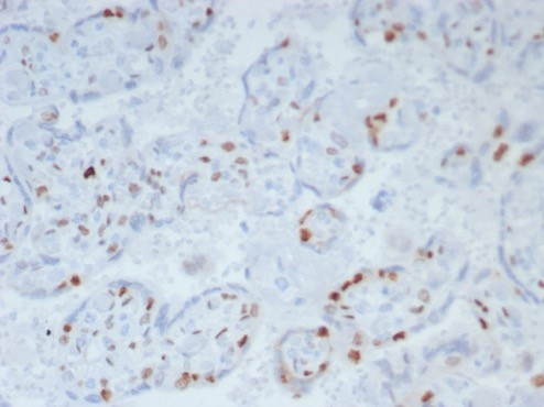 p57 Kip2 Antibody (KIP2/8169R)